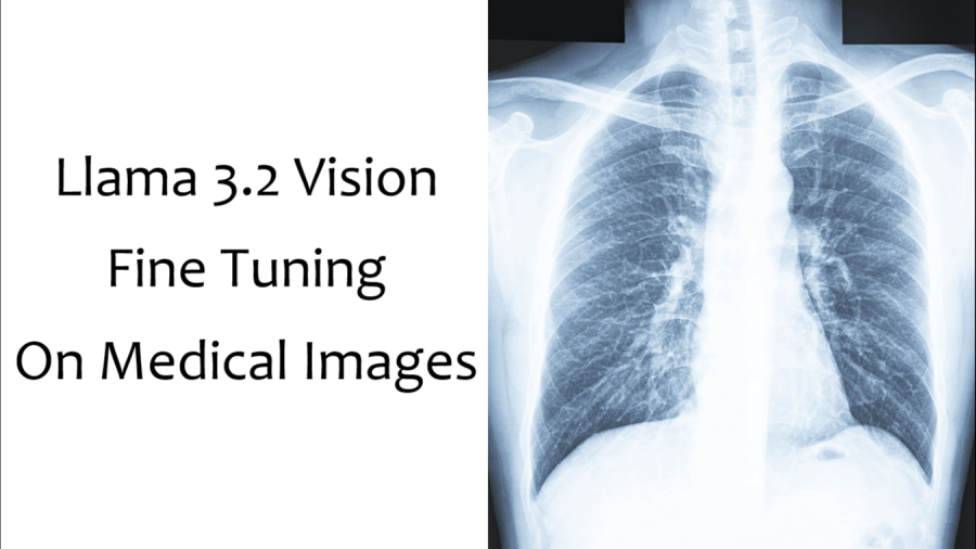 Llama 3.2 Vision医学图像微调